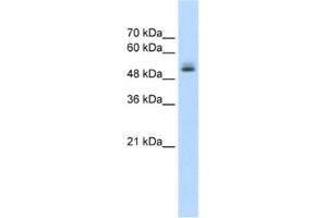 Western Blotting (WB) image for anti-Pre-mRNA Processing Factor 19 (PRPF19) antibody (ABIN2462670) (PRP19 antibody)