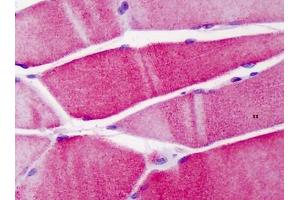 Human Skeletal Muscle: Formalin-Fixed, Paraffin-Embedded (FFPE) (ACTN3 antibody  (N-Term))