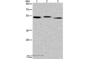 Western blot analysis of Human kidney tissue, HepG2 cell and human testis tissue, using HYAL3 Polyclonal Antibody at dilution of 1:400 (HYAL3 antibody)