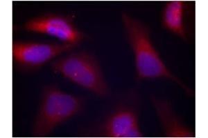 Image no. 3 for anti-Eukaryotic Translation Initiation Factor 2-alpha Kinase 2 (EIF2AK2) (pThr446) antibody (ABIN197048) (EIF2AK2 antibody  (pThr446))