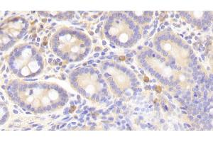 Immunohistochemistry (IHC) image for anti-Signal Transducer and Activator of Transcription 1, 91kDa (STAT1) (AA 343-602) antibody (ABIN7443806)