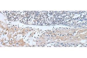 Immunohistochemistry of paraffin-embedded Human tonsil tissue using ABR Polyclonal Antibody at dilution of 1:50(x200) (ABR antibody)