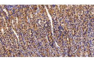 Immunohistochemistry (IHC) image for anti-Trefoil Factor 2 (TFF2) (AA 25-127) antibody (ABIN7432517)