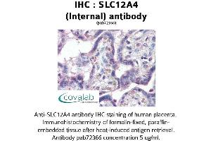 Image no. 1 for anti-Solute Carrier Family 12 (Potassium-Chloride Transporter) Member 4 (SLC12A4) (Internal Region) antibody (ABIN1739330) (SLC12A4 antibody  (Internal Region))