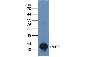 Mouse Capture antibody from the kit in WB with Positive Control: Human Lymphocyte lysate. (S100A8 ELISA Kit)