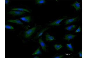 Immunofluorescence of purified MaxPab antibody to EIF4B on HeLa cell. (EIF4B antibody  (AA 1-611))