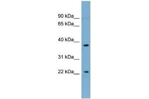 WB Suggested Anti-FOXN4 Antibody Titration:  0. (FOXN4 antibody  (Middle Region))