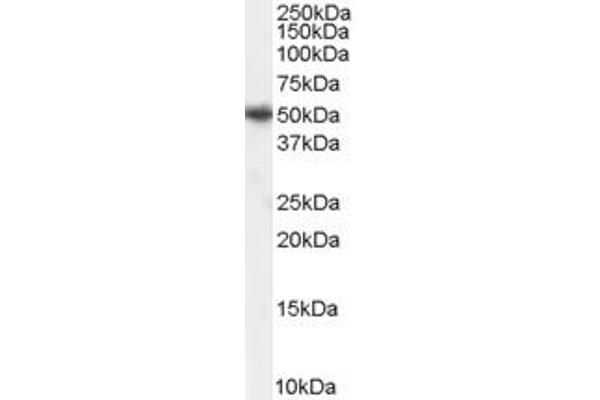 PICK1 antibody  (Internal Region)