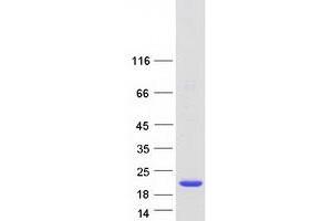 Validation with Western Blot