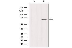 Western blot analysis of extracts from hepg2, using USP39 antibody.