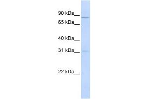 POMT1 antibody used at 1 ug/ml to detect target protein.
