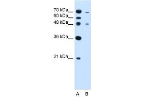 ZFYVE27 antibody used at 2.