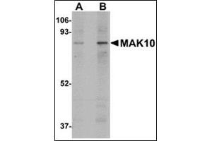 Western blot analysis of MAK10 in mouse heart tissue lysate with this product at (A) 1 and (B) 2 μg/ml. (MAK10/NAA35 antibody  (Center))