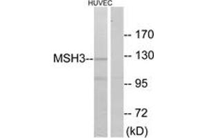 Western blot analysis of extracts from HuvEc cells, using MSH3 Antibody. (MSH3 antibody  (AA 51-100))