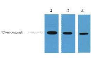 Western Blotting (WB) image for anti-T7-Tag antibody (ABIN3181085) (T7-Tag antibody)