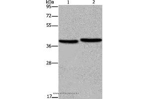 Western blot analysis of MCF-7 and NIH/3T3 cell, using FHL1 Polyclonal Antibody at dilution of 1:400 (FHL1 antibody)