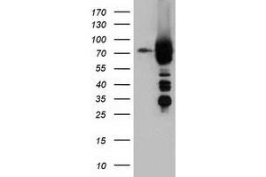 HEK293T cells were transfected with the pCMV6-ENTRY control (Left lane) or pCMV6-ENTRY ARHGAP25 (Right lane) cDNA for 48 hrs and lysed. (ARHGAP25 antibody)