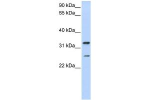 WB Suggested Anti-KCNIP2 Antibody Titration:  0. (KCNIP2 antibody  (N-Term))