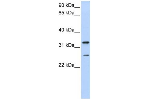 KCNIP2 anticorps  (N-Term)