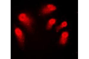 Immunofluorescent analysis of AIRE staining in Jurkat cells. (AIRE antibody  (Center))