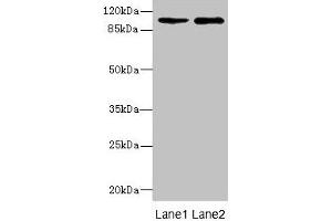 Western blot All lanes: GRIK3 antibody at 1. (GRIK3 antibody  (AA 32-240))
