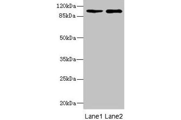 GRIK3 Antikörper  (AA 32-240)