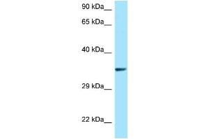WB Suggested Anti-QKI AntibodyTitration: 1. (QKI antibody  (N-Term))
