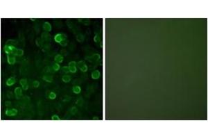 Immunofluorescence analysis of A549 cells, using E-cadherin Antibody. (E-cadherin antibody  (AA 1-50))