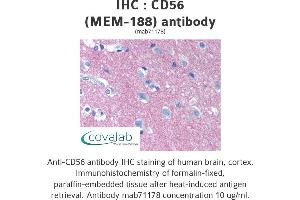Image no. 1 for anti-Neural Cell Adhesion Molecule 1 (NCAM1) antibody (ABIN1724016) (CD56 antibody)