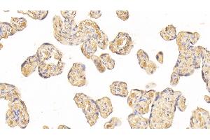 Detection of AT in Human Placenta Tissue using Monoclonal Antibody to Antithrombin (AT) (SERPINC1 antibody)