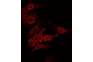 ABIN6274849 staining Hela by IF/ICC. (ANGPTL7 antibody  (C-Term))