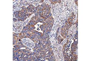 IHC analysis of EML4 using anti-EML4 antibody (ABIN6719384). (EML4 antibody  (AA 207-423))