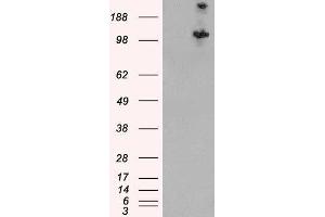 HEK293 overexpressing Human TSC1 and probed with ABIN2562994 (mock transfection in first lane). (TSC1 antibody  (C-Term, Isoform 1))