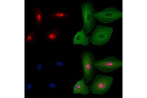 ABIN6260738 and ABIN6279258 staining  cells by IF/ICC.