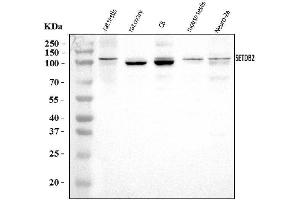 Western blot analysis of CLLD8/Setdb2 using anti-CLLD8/Setdb2 antibody (ABIN7600560).