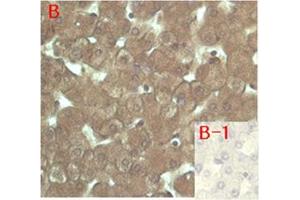 Immunohistochemical staining of human tissue using anti-FGF-23 (human), mAb (FG322-3)  at 1:200 dilution. (FGF23 antibody)