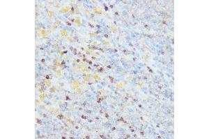 Immunohistochemistry of paraffin-embedded rat spleen using NEDD9 Rabbit pAb (ABIN3023330, ABIN3023331, ABIN3023332 and ABIN6219606) at dilution of 1:100 (40x lens). (NEDD9 antibody  (AA 60-174))