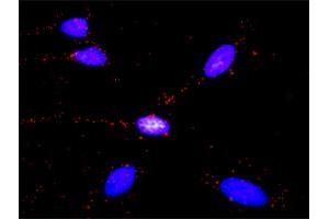 Proximity Ligation Analysis of protein-protein interactions between SMAD1 and GLI3. (GLI3 antibody  (AA 1-110))