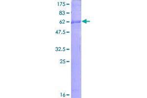 Image no. 1 for Chemokine (C-X-C Motif) Receptor 6 (CXCR6) (AA 1-342) protein (GST tag) (ABIN1350846)