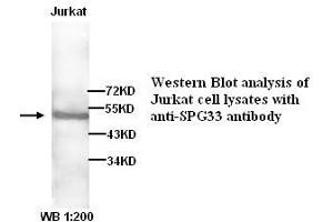 Image no. 1 for anti-Zinc Finger, FYVE Domain Containing 27 (ZFYVE27) antibody (ABIN790894) (ZFYVE27 antibody)