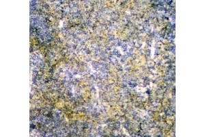 IHC analysis of MPI using anti-MPI antibody (ABIN4886672). (MPI antibody  (AA 2-99))