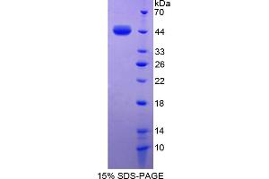 Image no. 1 for S100 Calcium Binding Protein A7 (S100A7) (AA 1-101) protein (His tag,GST tag) (ABIN4988987) (S100A7 Protein (AA 1-101) (His tag,GST tag))