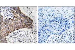 Immunohistochemistry analysis of paraffin-embedded human tonsil tissue, using C1QBP Antibody. (C1QBP antibody  (AA 61-110))