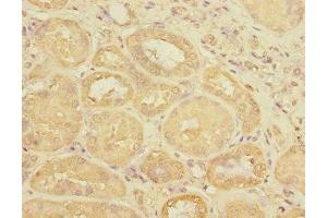 Immunohistochemistry of paraffin-embedded human kidney tissue using ABIN7175143 at dilution of 1:100 (Uroplakin 3A antibody  (AA 19-207))