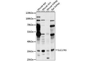 Western blot analysis of extracts of various cell lines, using SLC17A5 antibody (ABIN6294219) at 1:1000 dilution. (Solute Carrier Family 17 (Acidic Sugar Transporter), Member 5 (SLC17A5) antibody)