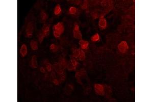 Immunofluorescence (IF) image for anti-Sarcolemma Associated Protein (SLMAP) (N-Term) antibody (ABIN7273079) (SLMAP antibody  (N-Term))