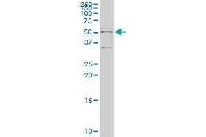 API5 monoclonal antibody (M01), clone 1C2 Western Blot analysis of API5 expression in Hela S3 NE . (Apoptosis Inhibitor 5 antibody  (AA 400-504))