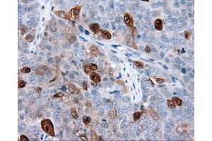 Immunohistochemical staining of paraffin-embedded Kidney tissue using anti-ANXA1 mouse monoclonal antibody.