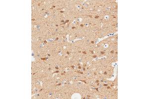 Immunohistochemical analysis of paraffin-embedded Human brain tissue using A performed on the Leica® BOND RXm. (TUBB2B antibody  (N-Term))