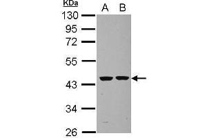 WB Image Sample (30 ug of whole cell lysate) A: U87-MG B: SK-N-SH 10% SDS PAGE antibody diluted at 1:1000 (Septin 2 antibody)
